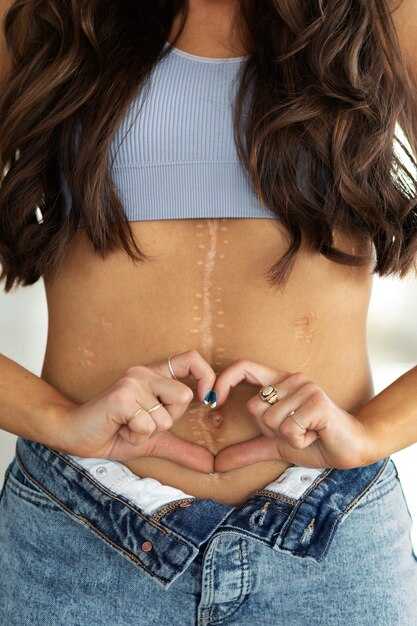 Почему мы видим шрамы в своих снах?