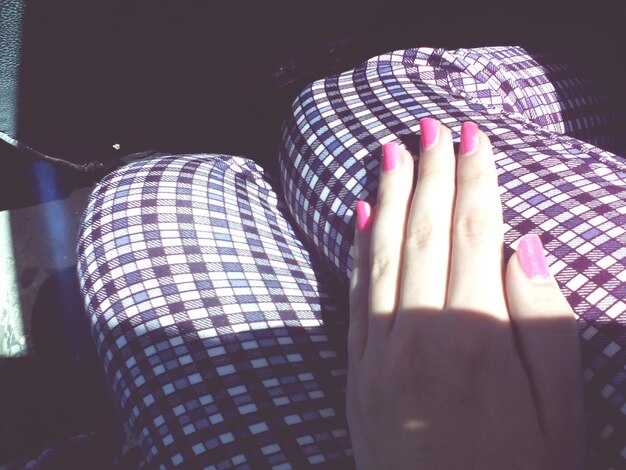 Обожженные руки и судьбоносные знаки: что нужно учитывать?