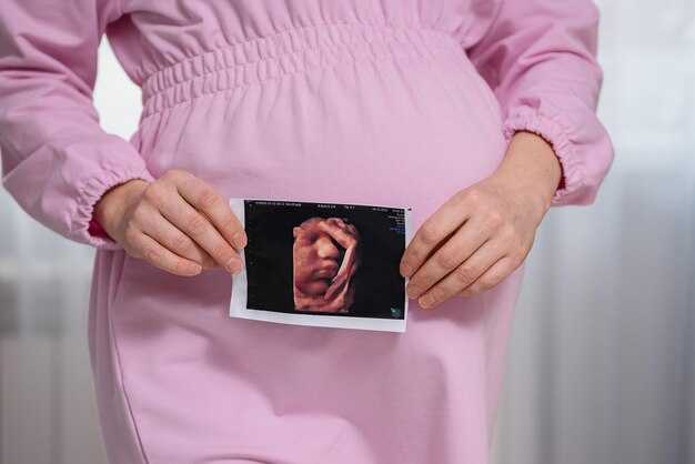 Фотографии плода на 12 неделе: что ожидать