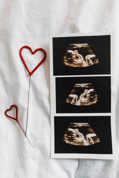 Когда видно пол ребенка на УЗИ