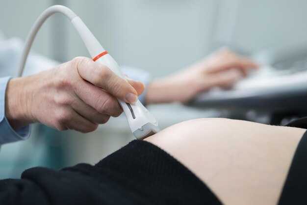 Подготовка к процедуре: что нужно знать беременной