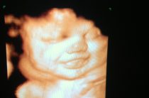 12 недель: Ваш малыш размером с лайм и уже вовсю строит рожицы