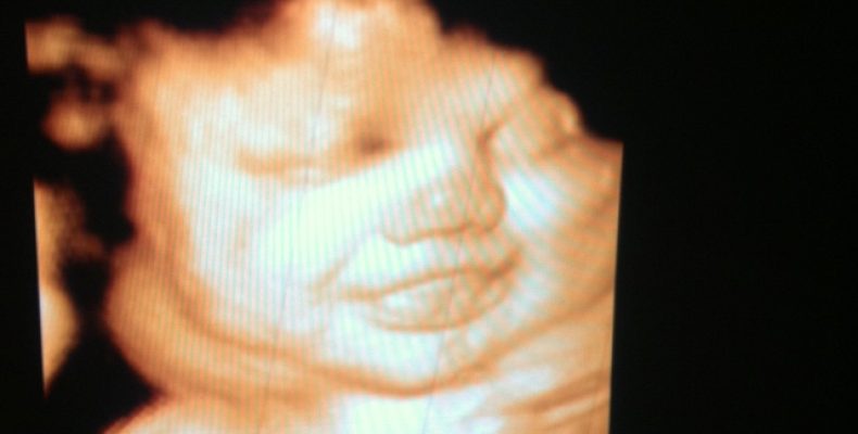 12 недель: Ваш малыш размером с лайм и уже вовсю строит рожицы