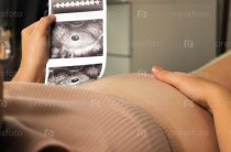 12 недель беременности: главный скрининг, который нельзя пропустить