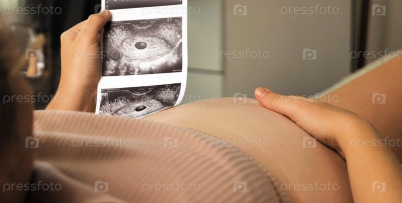 12 недель беременности: главный скрининг, который нельзя пропустить