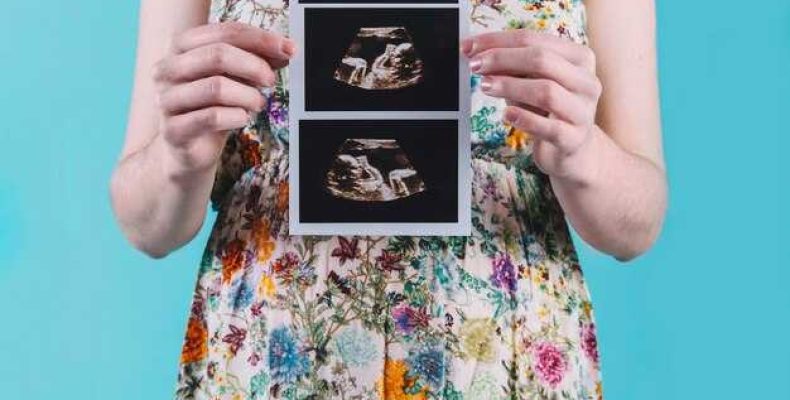 9 недель беременности как выглядит ребенок