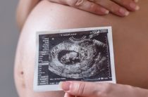 12 недель беременности: главные вопросы о генетическом тесте, которые вы боитесь задать