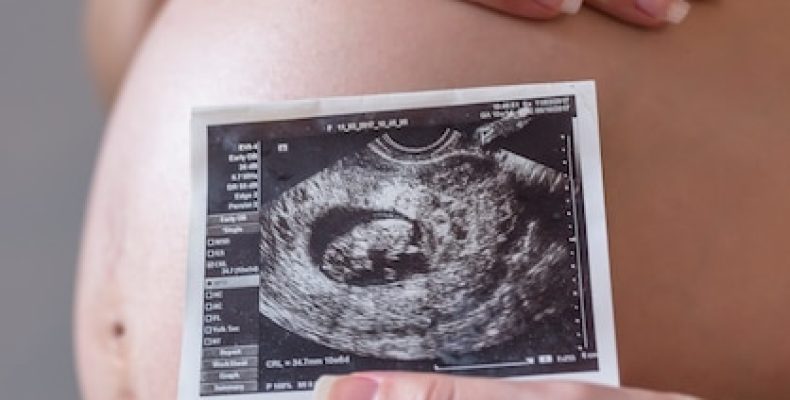 12 недель беременности: главные вопросы о генетическом тесте, которые вы боитесь задать